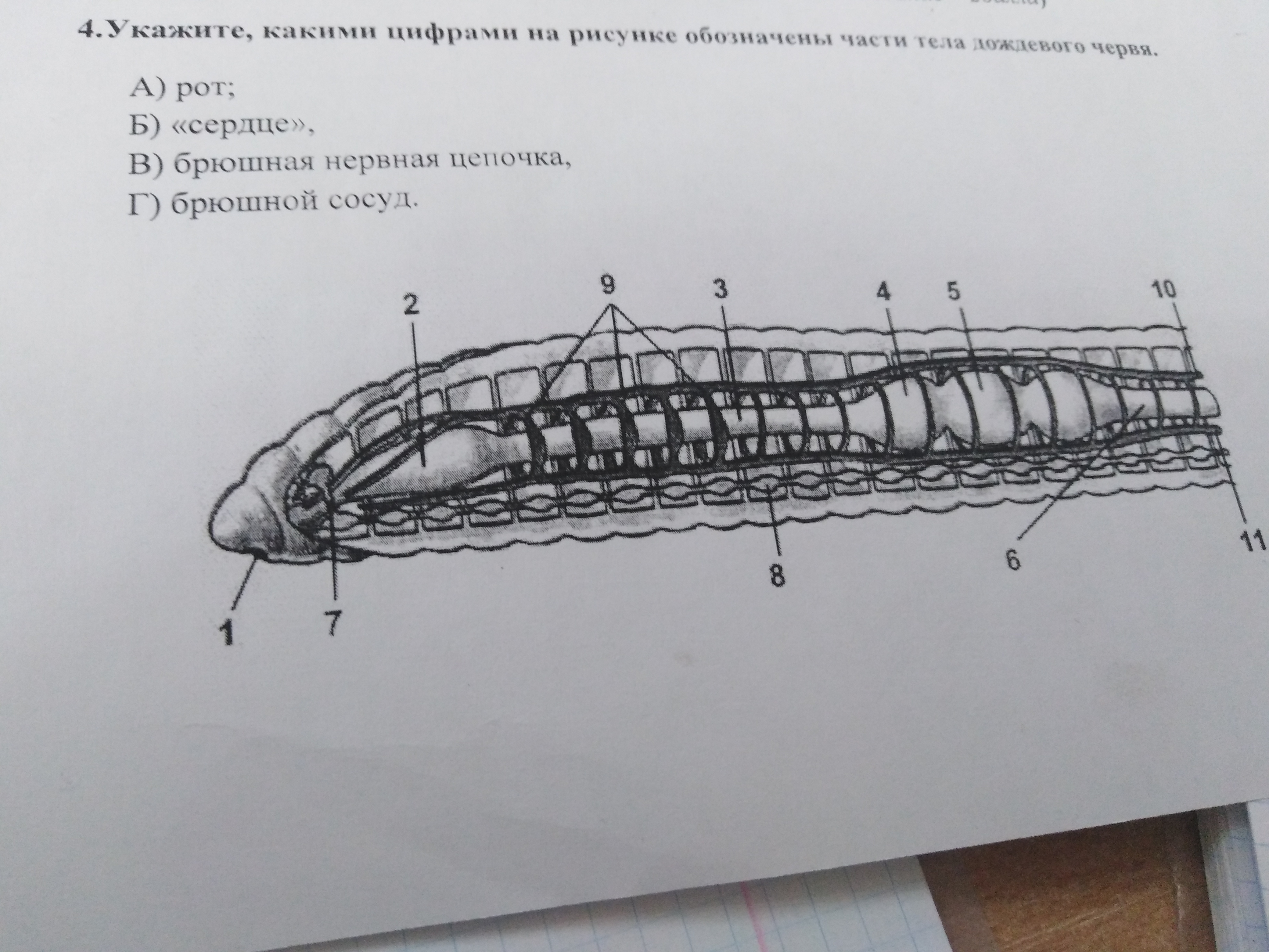 Какую функцию выполняет брюшная нервная цепочка. Строение дождевого червя. Система органов дождевого червя. Внутреннее строение дождевого червя. Спинная и брюшная часть тела дождевого червя.