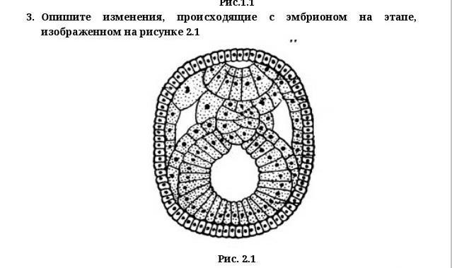 Какой цифрой на рисунке изображена стадия